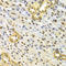 Tumor Protein P63 antibody, LS-C331932, Lifespan Biosciences, Immunohistochemistry paraffin image 