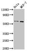 Matrix metalloproteinase-28 antibody, CSB-PA880950LA01HU, Cusabio, Western Blot image 