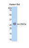 Laminin subunit alpha-4 antibody, LS-C299869, Lifespan Biosciences, Western Blot image 