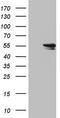 RAD23 Homolog B, Nucleotide Excision Repair Protein antibody, TA804867, Origene, Western Blot image 