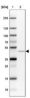 ADCYAP Receptor Type I antibody, NBP2-47340, Novus Biologicals, Western Blot image 