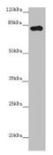 Leucine Rich Repeats And Calponin Homology Domain Containing 1 antibody, CSB-PA897471LA01HU, Cusabio, Western Blot image 