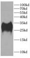 Carbonic anhydrase 2 antibody, FNab01161, FineTest, Western Blot image 