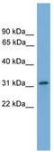 Phosphatidylinositol Glycan Anchor Biosynthesis Class L antibody, TA339405, Origene, Western Blot image 