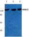 Histone deacetylase 5 antibody, AP06158PU-N, Origene, Western Blot image 