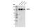 Transient Receptor Potential Cation Channel Subfamily C Member 3 antibody, 77934S, Cell Signaling Technology, Western Blot image 