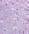 BAX antibody, orb4655, Biorbyt, Immunohistochemistry paraffin image 