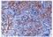 Leukocyte Cell Derived Chemotaxin 2 antibody, GTX52904, GeneTex, Immunohistochemistry frozen image 