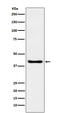 Speckle-type POZ protein antibody, M02032, Boster Biological Technology, Western Blot image 