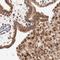 Ribosomal Protein L12 antibody, HPA003403, Atlas Antibodies, Immunohistochemistry frozen image 