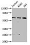 Elongator complex protein 3 antibody, CSB-PA884499LA01HU, Cusabio, Western Blot image 