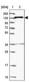 N(Alpha)-Acetyltransferase 16, NatA Auxiliary Subunit antibody, PA5-59084, Invitrogen Antibodies, Western Blot image 