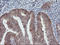 Coenzyme A Synthase antibody, LS-C173206, Lifespan Biosciences, Immunohistochemistry paraffin image 