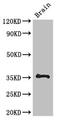 N-acetylneuraminate lyase antibody, orb52330, Biorbyt, Western Blot image 