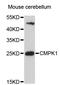 Cytidine/Uridine Monophosphate Kinase 1 antibody, STJ111229, St John