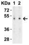 Solute Carrier Family 39 Member 7 antibody, 6093, ProSci Inc, Western Blot image 