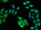 Eukaryotic translation initiation factor 3 subunit M antibody, orb53499, Biorbyt, Immunofluorescence image 
