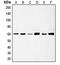 SRC Proto-Oncogene, Non-Receptor Tyrosine Kinase antibody, GTX32263, GeneTex, Western Blot image 