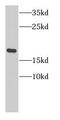 Nuclear Cap Binding Protein Subunit 2 antibody, FNab01324, FineTest, Western Blot image 