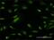 Zinc finger and BTB domain-containing protein 25 antibody, H00007597-M02, Novus Biologicals, Immunofluorescence image 