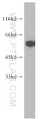 Thioredoxin Reductase 1 antibody, 11117-1-AP, Proteintech Group, Western Blot image 