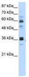 RNA Pseudouridine Synthase Domain Containing 2 antibody, TA344002, Origene, Western Blot image 