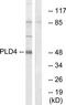 Phospholipase D Family Member 4 antibody, TA316060, Origene, Western Blot image 