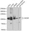 Minichromosome Maintenance Complex Component 5 antibody, GTX33310, GeneTex, Western Blot image 
