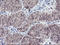 Cancer/Testis Antigen 1B antibody, LS-C174582, Lifespan Biosciences, Immunohistochemistry paraffin image 