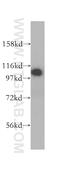 Rabaptin, RAB GTPase Binding Effector Protein 1 antibody, 14350-1-AP, Proteintech Group, Western Blot image 