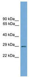 BARX Homeobox 2 antibody, TA342308, Origene, Western Blot image 