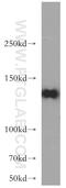 Regulating Synaptic Membrane Exocytosis 2 antibody, 20093-1-AP, Proteintech Group, Western Blot image 