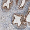 3-ketoacyl-CoA thiolase B, peroxisomal antibody, AMAb91020, Atlas Antibodies, Immunohistochemistry frozen image 