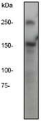 APC Regulator Of WNT Signaling Pathway antibody, TA303394, Origene, Western Blot image 