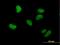 Probable histone-lysine N-methyltransferase NSD2 antibody, H00007468-B01P, Novus Biologicals, Immunofluorescence image 