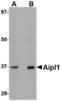 Aryl Hydrocarbon Receptor Interacting Protein Like 1 antibody, TA306665, Origene, Western Blot image 