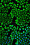Histamine N-Methyltransferase antibody, 18-684, ProSci, Immunofluorescence image 