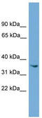 Ankyrin Repeat And SOCS Box Containing 17 antibody, TA340252, Origene, Western Blot image 