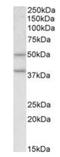 Ghrelin O-acyltransferase antibody, orb125149, Biorbyt, Western Blot image 