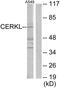 Ceramide Kinase Like antibody, PA5-38697, Invitrogen Antibodies, Western Blot image 