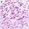 CD44 antibody, orb216050, Biorbyt, Immunohistochemistry paraffin image 