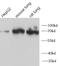 Moesin antibody, FNab05381, FineTest, Western Blot image 
