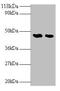 Lecithin-Cholesterol Acyltransferase antibody, orb240073, Biorbyt, Western Blot image 