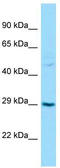 Transforming Growth Factor Beta Regulator 1 antibody, TA343010, Origene, Western Blot image 