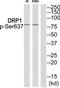 Dynamin-1-like protein antibody, TA312341, Origene, Western Blot image 