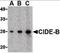 Cell Death Inducing DFFA Like Effector B antibody, orb86717, Biorbyt, Western Blot image 