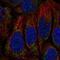 Distal Membrane Arm Assembly Complex 2 antibody, NBP2-14509, Novus Biologicals, Immunocytochemistry image 