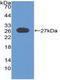 Ubiquitin carboxyl-terminal hydrolase CYLD antibody, LS-C314915, Lifespan Biosciences, Western Blot image 