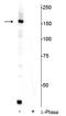 FA Complementation Group I antibody, P05108, Boster Biological Technology, Western Blot image 