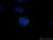 Centrosomal Protein 135 antibody, 24428-1-AP, Proteintech Group, Immunofluorescence image 